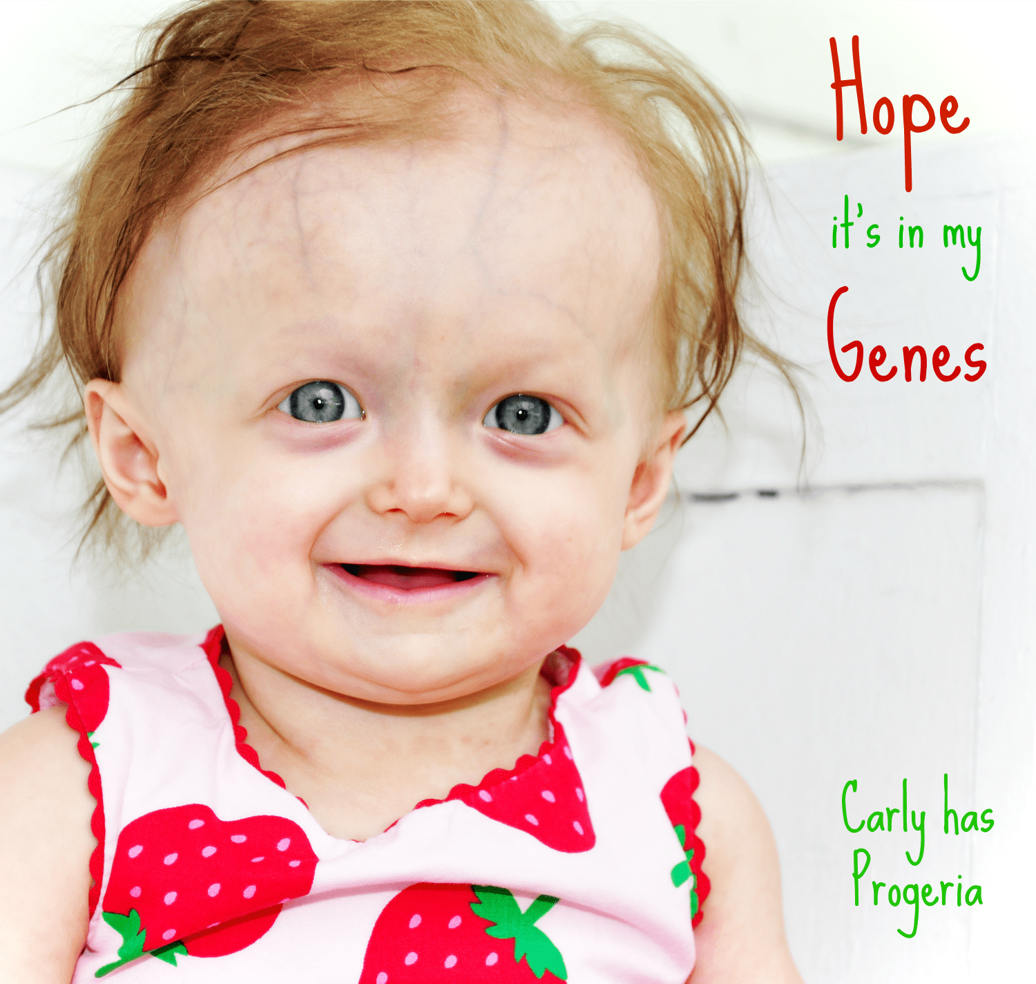 Carly suffers from Progeria, a fatal and rapid aging ...