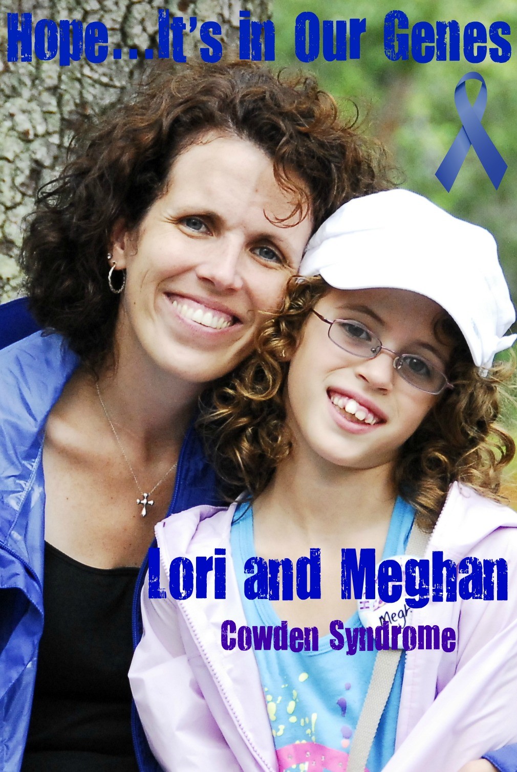 Cowden Syndrome Pictures